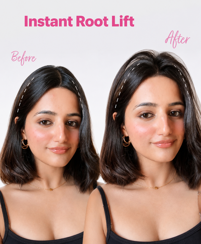 LUMÉRA™ RootLift Clips
